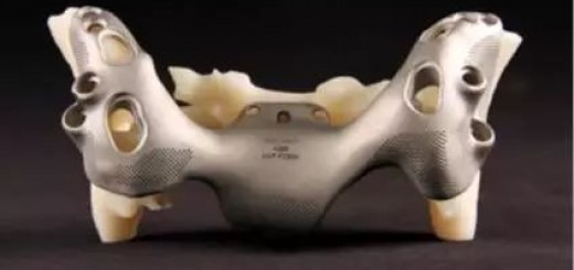 3dprint_implant_3dsystems_5